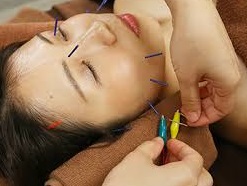 cosmetic electric acupuncture