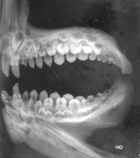 X-ray photo