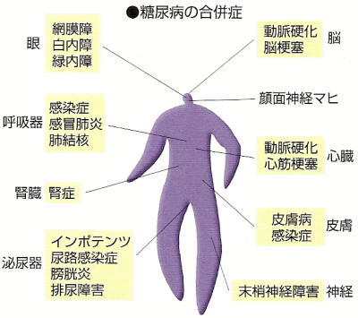 糖尿病の合併症